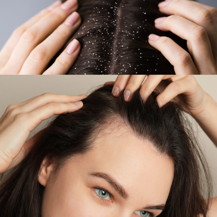 health of your scalp